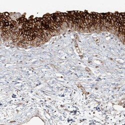 Uroplakin Ib Antibody, Novus Biologicals:Antibodies:Primary Antibodies