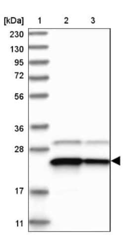 Use1/UBE2Z Antibody, Novus Biologicals 0.1mL; Unlabeled:Antibodies, Polyclonal
