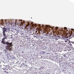 Uteroglobin/SCGB1A1 Antibody, Novus Biologicals 25 &mu;L, Unlabeled:Antibodies,