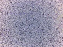 Novus Biologicals Uterus Tissue Slides (Endometrial Adenocarcinoma)- Paraffin 5 Objektträger | Buy Online | Novus Biologicals&trade; | Fisher Scientific