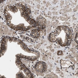 Utrophin Antibody, Novus Biologicals 0.1mL; Unlabeled:Antibodies, Polyclonal