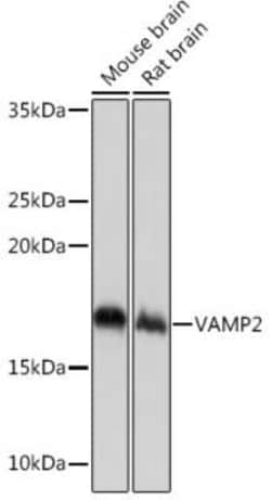 VAMP-2 Rabbit anti-Human, Mouse, Rat, Clone: 8X9D9, Novus Biologicals:Antibodies:Primary