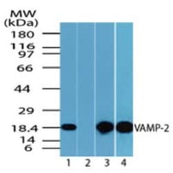 VAMP-2 Antibody, Novus Biologicals 0.025mg; Unlabeled:Antibodies, Polyclonal