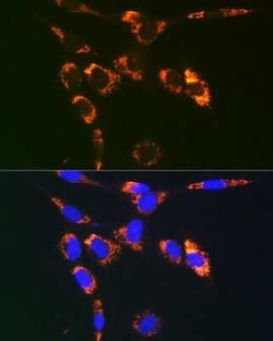 VAMP-7 Rabbit anti-Human, Mouse, Rat, Polyclonal, Novus Biologicals 20