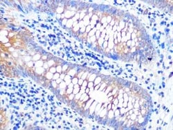 VAMP-8 Rabbit anti-Human, Mouse, Rat, Clone: 5H9S4, Novus Biologicals:Antibodies:Primary