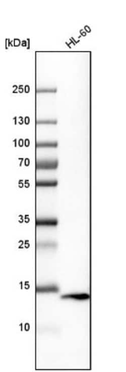 VAMP-8 Antibody, Novus Biologicals 0.1mL; Unlabeled:Antibodies, Polyclonal