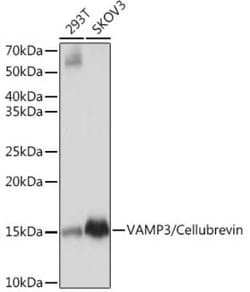 VAMP3/Cellubrevin Rabbit anti-Human, Mouse, Clone: 2H8R8, Novus Biologicals:Antibodies:Primary