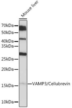 VAMP3/Cellubrevin Rabbit anti-Human, Mouse, Clone: 2H8R8, Novus Biologicals:Antibodies:Primary