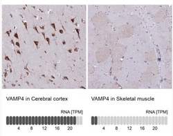 VAMP4 Antibody, Novus Biologicals 0.1mL; Unlabeled:Antibodies, Polyclonal