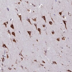 VAMP4 Antibody, Novus Biologicals 0.1mL; Unlabeled:Antibodies, Polyclonal