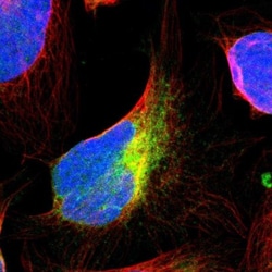 VAP-B Antibody, Novus Biologicals:Antibodies:Primary Antibodies
