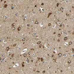 VAP-B Antibody, Novus Biologicals:Antibodies:Primary Antibodies
