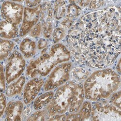 VAP-B Antibody, Novus Biologicals:Antibodies:Primary Antibodies