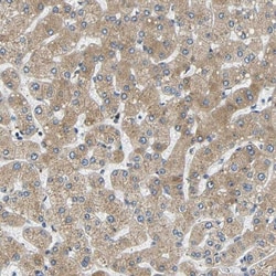 VAP-B Antibody, Novus Biologicals:Antibodies:Primary Antibodies