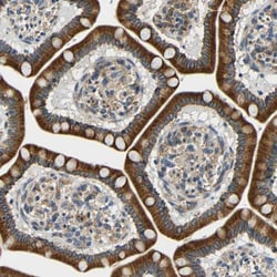 VAP-B Antibody, Novus Biologicals:Antibodies:Primary Antibodies