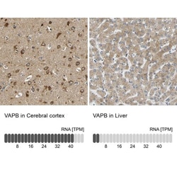 VAP-B Antibody, Novus Biologicals:Antibodies:Primary Antibodies