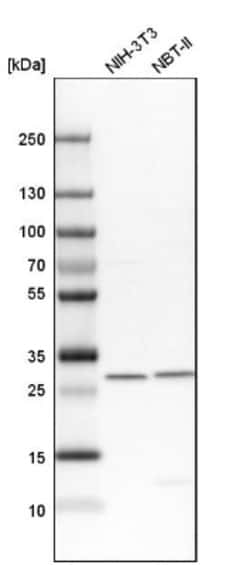 VAP-B Antibody, Novus Biologicals:Antibodies:Primary Antibodies