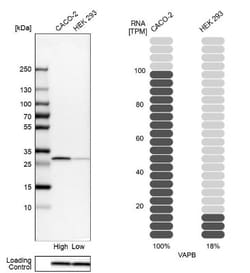 VAP-B Antibody, Novus Biologicals:Antibodies:Primary Antibodies