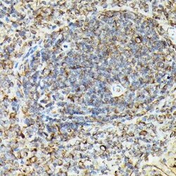 VASP Rabbit anti-Human, Mouse, Rat, Polyclonal, Novus Biologicals:Antibodies:Primary