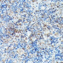VASP Rabbit anti-Human, Mouse, Rat, Polyclonal, Novus Biologicals:Antibodies:Primary