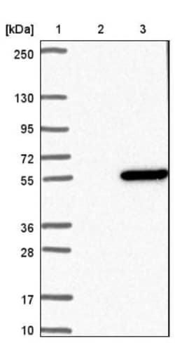 VAT1L Antibody, Novus Biologicals 25 &mu;L | Buy Online | Novus Biologicals | Fisher Scientific