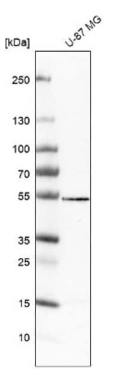 VAT1L Antibody, Novus Biologicals 25 &mu;L | Buy Online | Novus Biologicals | Fisher Scientific