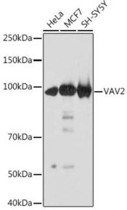 VAV2 Rabbit anti-Human, Mouse, Clone: 3S0O9, Novus Biologicals 100 &mu;g | Buy Online | Bio-Techne | Fisher Scientific