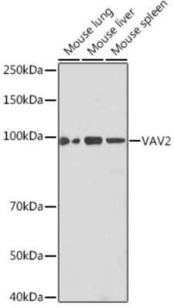 VAV2 Rabbit anti-Human, Mouse, Clone: 3S0O9, Novus Biologicals 100 &mu;g | Buy Online | Bio-Techne | Fisher Scientific