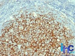 Mouse anti-VCAM-1/CD106, Clone: 1.4C3, Novus Biologicals 0.2mg; Unlabeled:Antibodies,