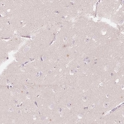 VCAM-1/CD106 Antibody, Novus Biologicals:Antibodies:Primary Antibodies