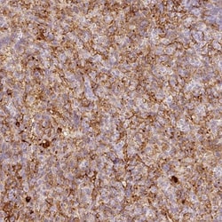 VCAM-1/CD106 Antibody, Novus Biologicals:Antibodies:Primary Antibodies