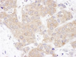 VCIP135/VCPIP1 Antibody, Novus Biologicals 0.1mL; Unlabeled:Antibodies,