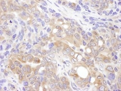 VCIP135/VCPIP1 Antibody, Novus Biologicals 0.1mL; Unlabeled:Antibodies,