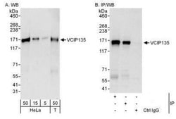 VCIP135/VCPIP1 Antibody, Novus Biologicals 0.1mL; Unlabeled:Antibodies,