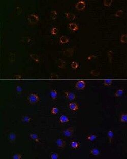 VDAC1 Rabbit anti-Human, Mouse, Rat, Clone: 6B1K1, Novus Biologicals 100