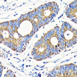 VDAC1 Rabbit anti-Human, Mouse, Rat, Clone: 6B1K1, Novus Biologicals 100