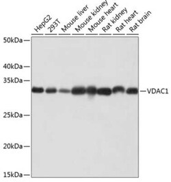 VDAC1 Rabbit anti-Human, Mouse, Rat, Clone: 6B1K1, Novus Biologicals 100