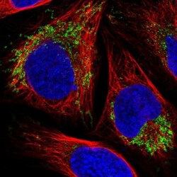 VDAC2 Antibody, Novus Biologicals 0.1mL; Unlabeled:Antibodies, Polyclonal