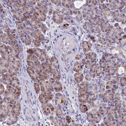 VDAC2 Antibody, Novus Biologicals 0.1mL; Unlabeled:Antibodies, Polyclonal