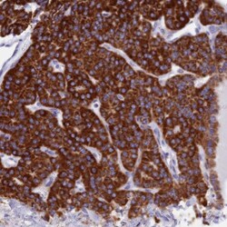 VDAC2 Antibody, Novus Biologicals 0.1mL; Unlabeled:Antibodies, Polyclonal