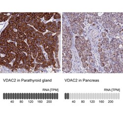 VDAC2 Antibody, Novus Biologicals 0.1mL; Unlabeled:Antibodies, Polyclonal