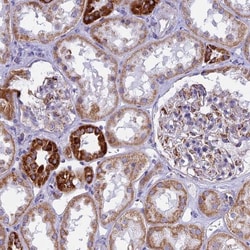 VDAC2 Antibody, Novus Biologicals 0.1mL; Unlabeled:Antibodies, Polyclonal