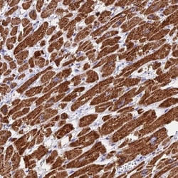 VDAC2 Antibody, Novus Biologicals 0.1mL; Unlabeled:Antibodies, Polyclonal