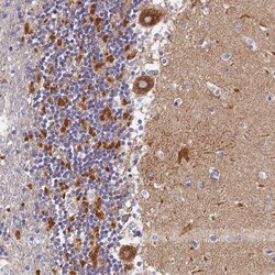 VDAC2 Antibody, Novus Biologicals 0.1mL; Unlabeled:Antibodies, Polyclonal