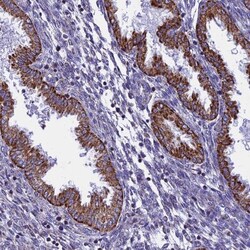VDAC2 Antibody, Novus Biologicals 0.1mL; Unlabeled:Antibodies, Polyclonal