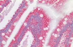 VDAC2 Antibody, Novus Biologicals 50 &mu;g | Buy Online | Novus Biologicals | Fisher Scientific