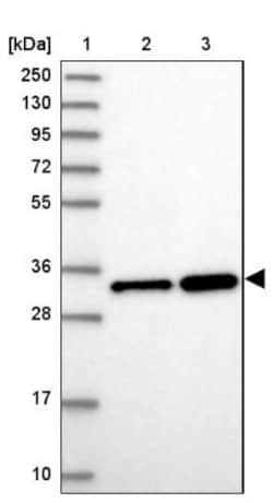 VDAC2 Antibody, Novus Biologicals 0.1mL; Unlabeled:Antibodies, Polyclonal
