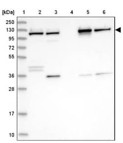 VDP p115 Antibody, Novus Biologicals 0.1mL; Unlabeled:Antibodies, Polyclonal