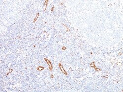 VEGF Antibody (VEGF/1063), Novus Biologicals 0.2mg; Unlabeled:Antibodies,
