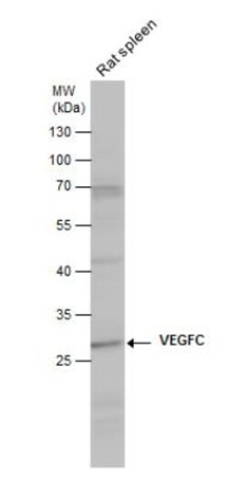 VEGF-C Antibody, Novus Biologicals 0.1mL; Unlabeled:Antibodies, Polyclonal